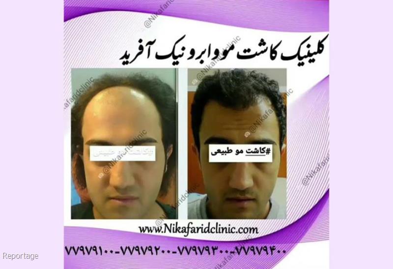 کلینیک پوست و مو نیک آفرید